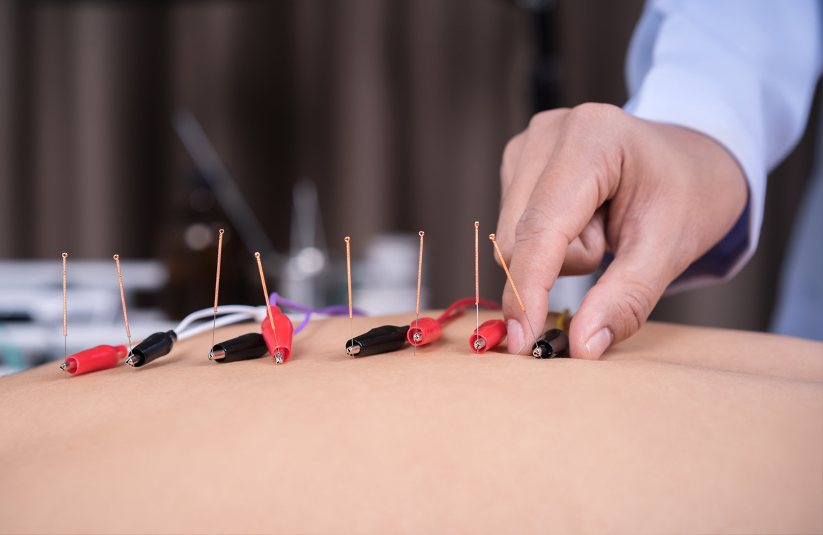 neuromodulación para el alivio del dolor crónico